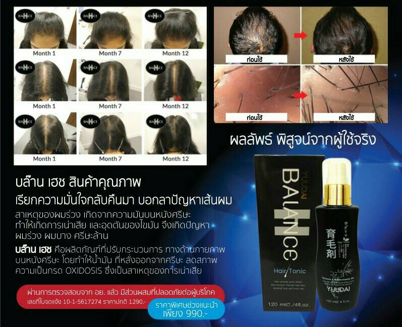 BALANCE H (Hair Tonic) ปลูกผมขั้นเทพ