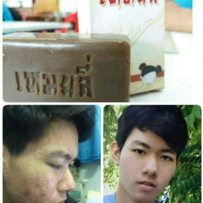 สบู่