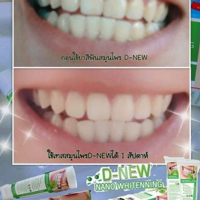D-NEW ยาสีฟันเพื่อสุขภาพช่องปาก วีเก้า (ยืนยันการสั่งซื้อติดต่อร้านค้านะครับ)